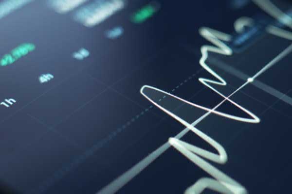 赵兴言：黄金4730空单迎来收获，欧盘思路解读！